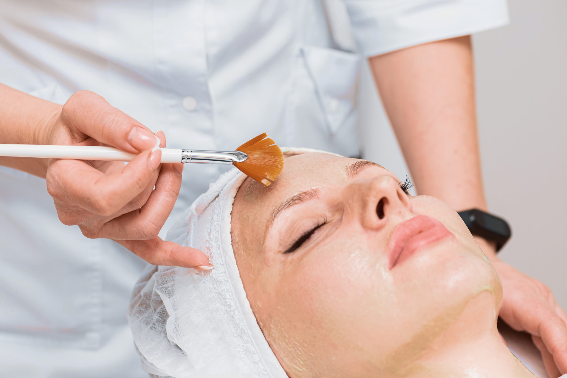 Fruchtsäurepeeling wird mit Pinsel im Gesicht aufgetragen – JOUST Medical Cosmetic