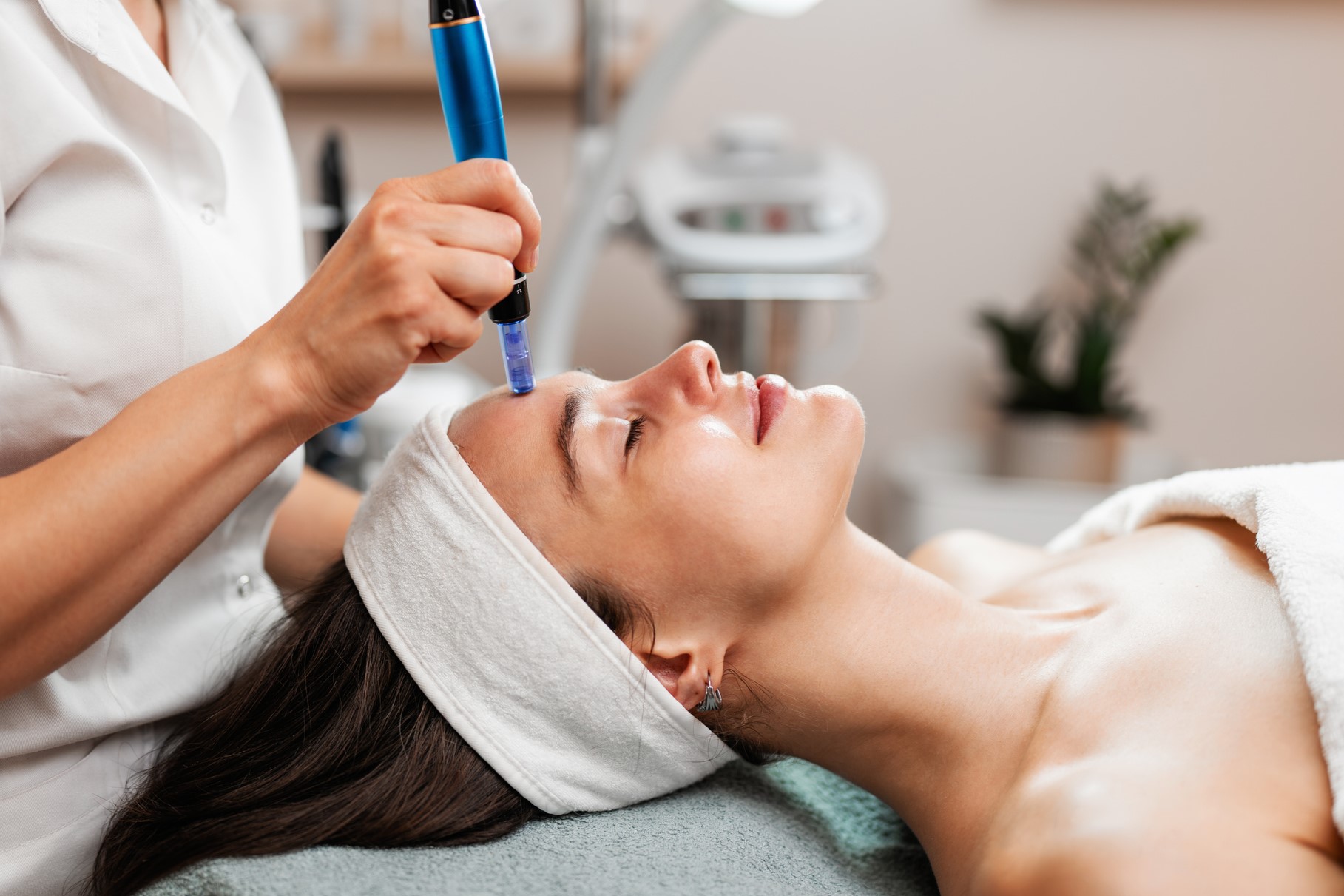 Needling-Anwendung im Gesicht bei JOUST Medical Cosmetic in Ludwigsburg